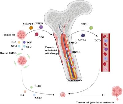 Mechanism and clinical progression of solid tumors bone marrow metastasis